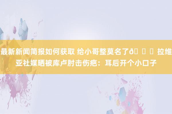 最新新闻简报如何获取 给小哥整莫名了😅拉维亚社媒晒被库卢肘击伤疤：耳后开个小口子